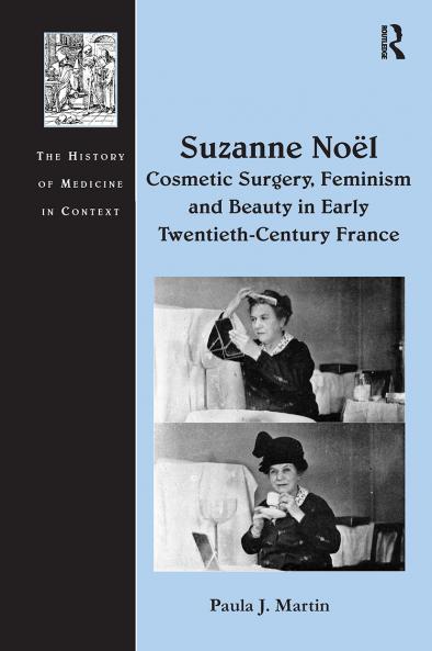 Suzanne Noël: Cosmetic Surgery Feminism and Beauty in Early Twentieth-Century France