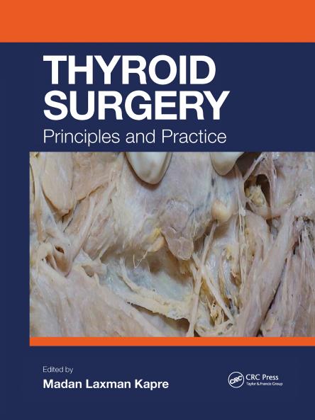 Thyroid Surgery