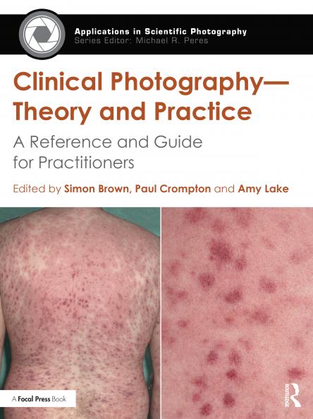 Clinical Photography -- Theory and Practice