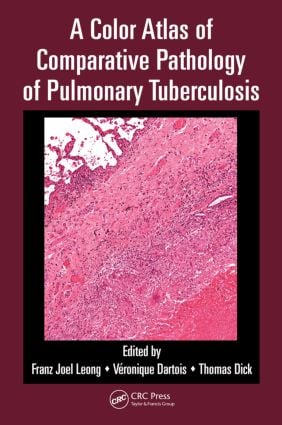 Color Atlas of Comparative Pathology of Pulmonary Tuberculosis