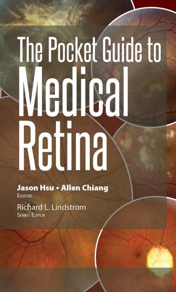 Pocket Guide to Medical Retina