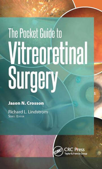 Pocket Guide to Vitreoretinal Surgery