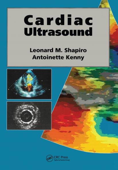 Cardiac Ultrasound
