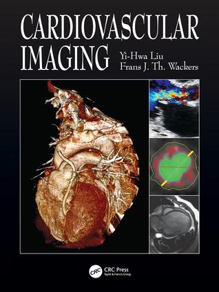 Cardiovascular Imaging