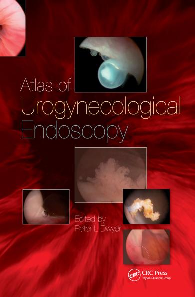 Handbook of Urologic Cryoablation