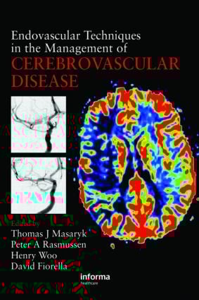 Endovascular Techniques in the Management of Cerebrovascular Disease