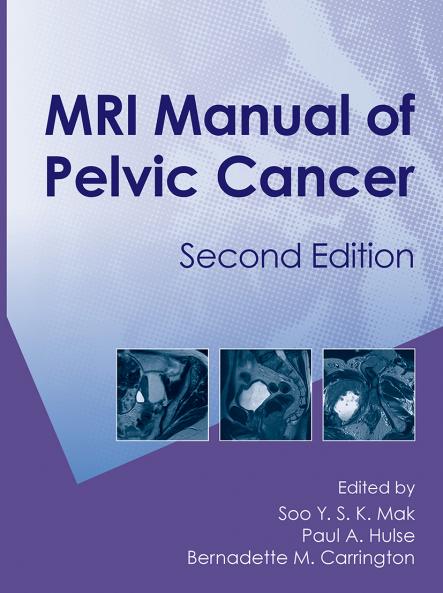 MRI Manual of Pelvic CancerSecond Edition
