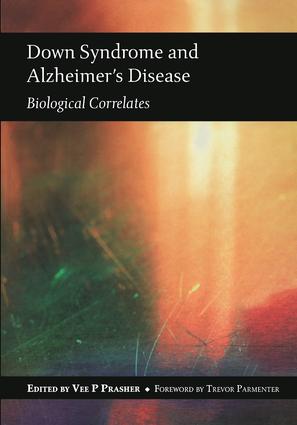 Down Syndrome and Alzheimer's Disease