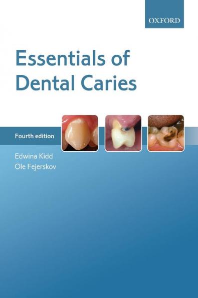 ESSENTIALS OF DENTAL CARIES 4E P