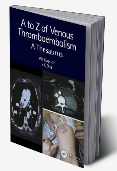 A to Z of Venous Thromboembolism