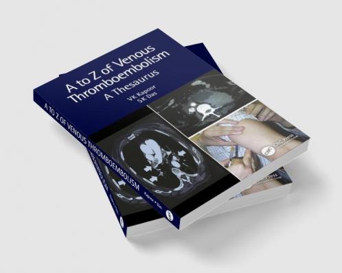 A to Z of Venous Thromboembolism