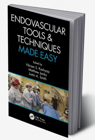 Endovascular Tools and Techniques Made Easy