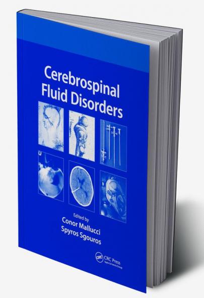 Cerebrospinal Fluid Disorders