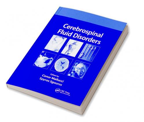 Cerebrospinal Fluid Disorders