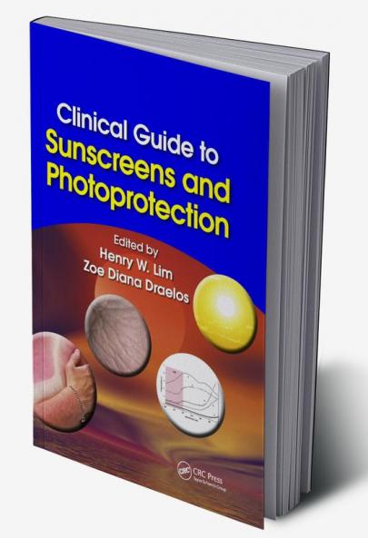 Clinical Guide to Sunscreens and Photoprotection