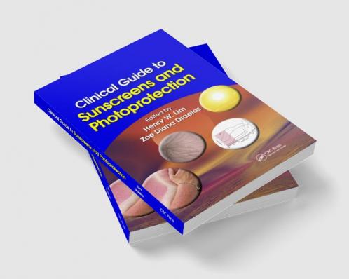 Clinical Guide to Sunscreens and Photoprotection