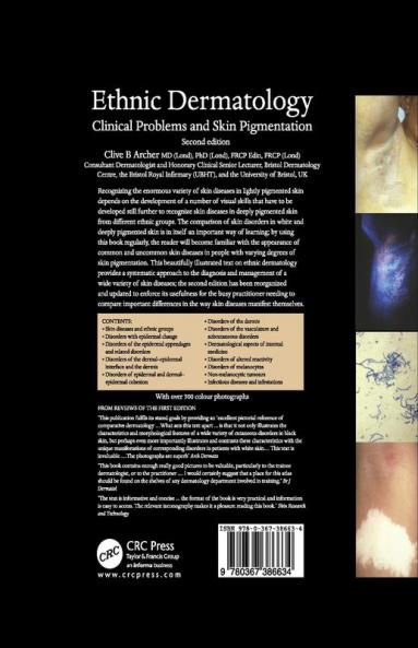 Ethnic Dermatology