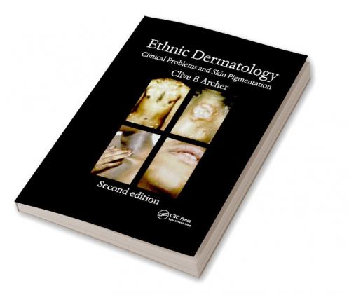 Ethnic Dermatology