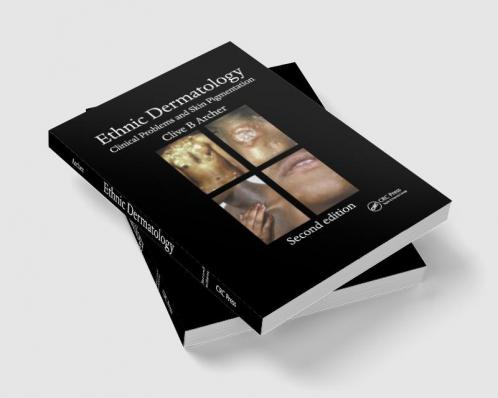Ethnic Dermatology