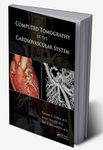 Computed Tomography of the Cardiovascular System