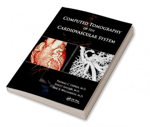 Computed Tomography of the Cardiovascular System