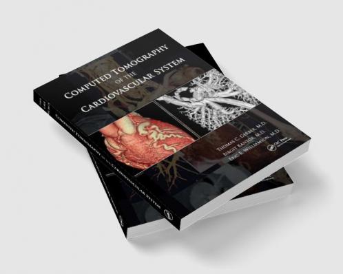 Computed Tomography of the Cardiovascular System
