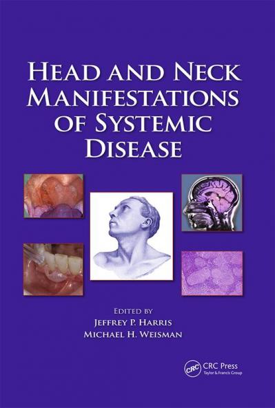 Head and Neck Manifestations of Systemic Disease