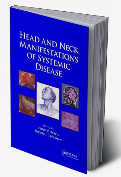 Head and Neck Manifestations of Systemic Disease