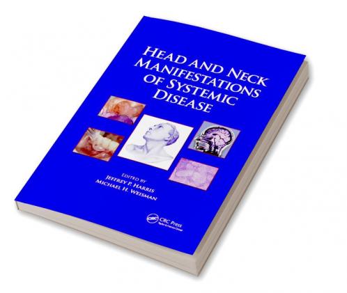 Head and Neck Manifestations of Systemic Disease