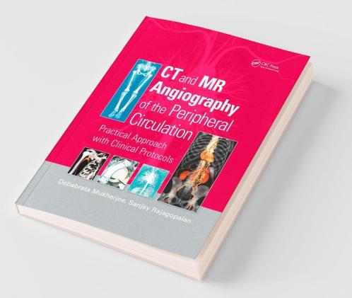 CT and MR Angiography of the Peripheral Circulation