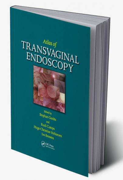 Atlas of Transvaginal Endoscopy