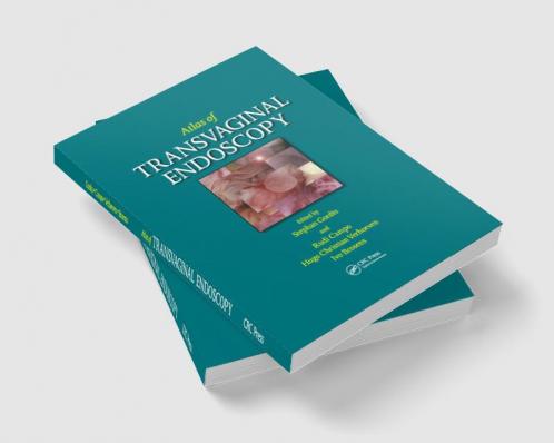 Atlas of Transvaginal Endoscopy