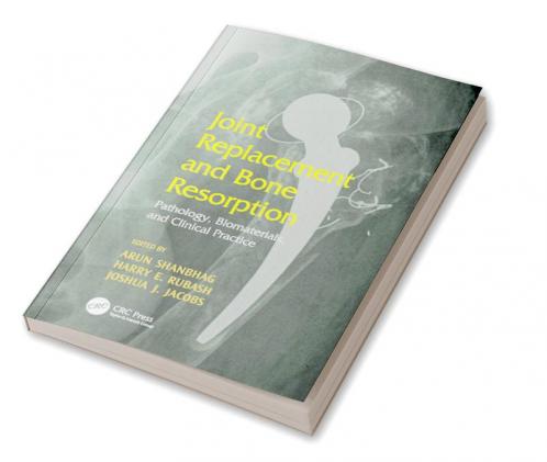 Joint Replacement and Bone Resorption