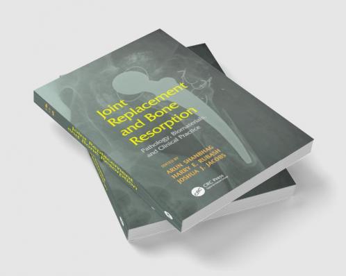 Joint Replacement and Bone Resorption