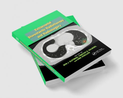 Extracranial Stereotactic Radiotherapy and Radiosurgery