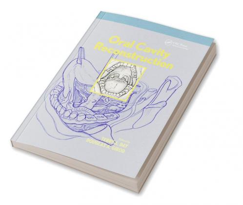 Oral Cavity Reconstruction