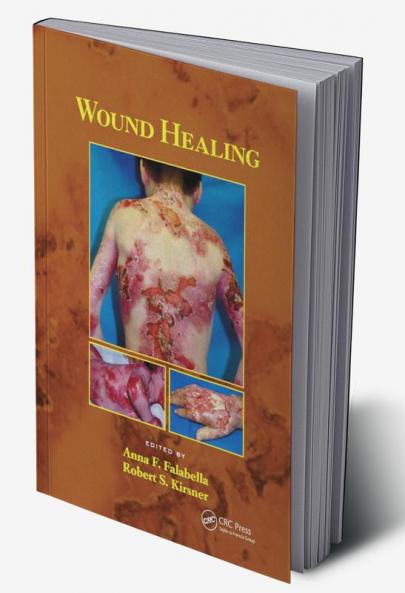 Wound Healing