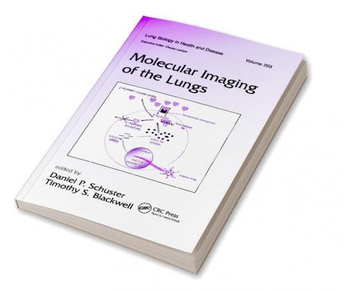 Molecular Imaging of the Lungs
