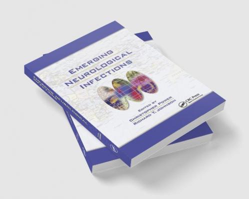 Emerging Neurological Infections