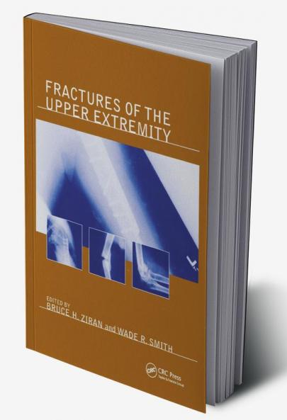 Fractures of the Upper Extremity