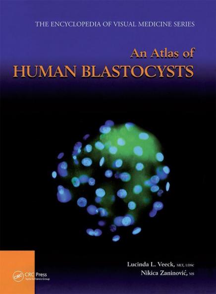 Atlas of Human Blastocysts