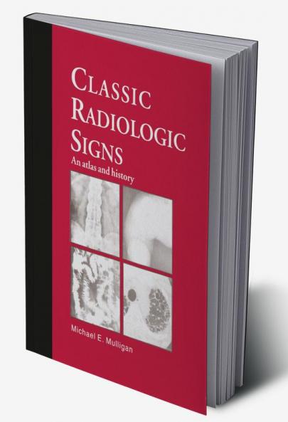 Classic Radiologic Signs