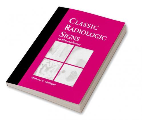 Classic Radiologic Signs