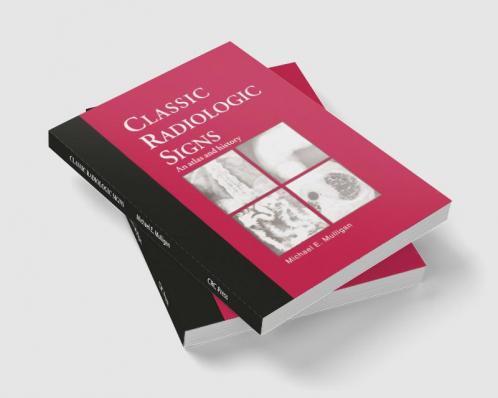 Classic Radiologic Signs