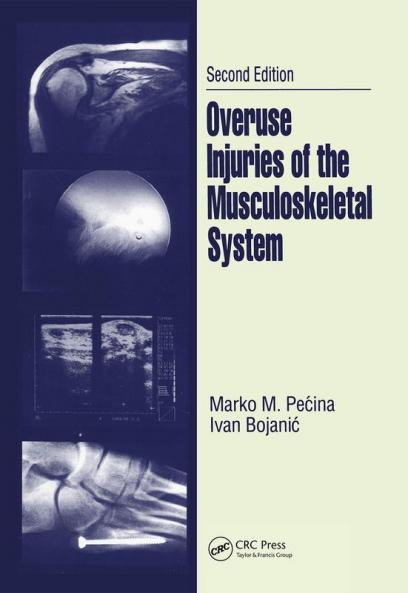 Overuse Injuries of the Musculoskeletal System Second Edition