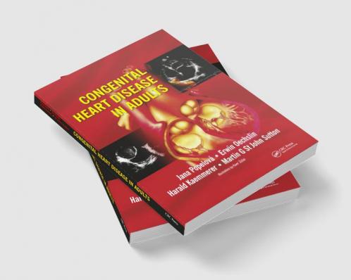 Congenital Heart Disease in Adults