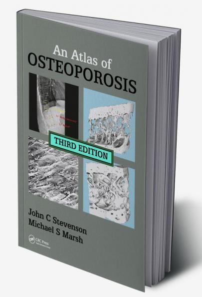 Atlas of Osteoporosis