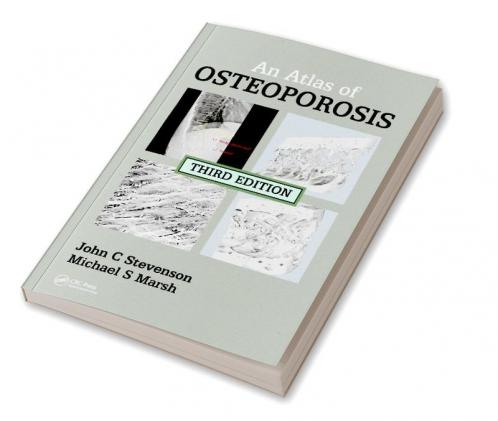 Atlas of Osteoporosis