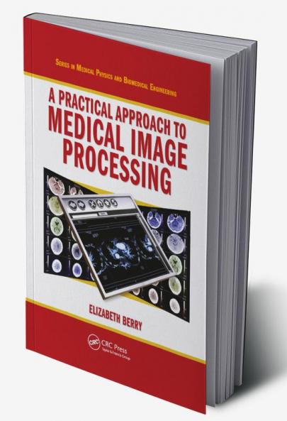 Practical Approach to Medical Image Processing