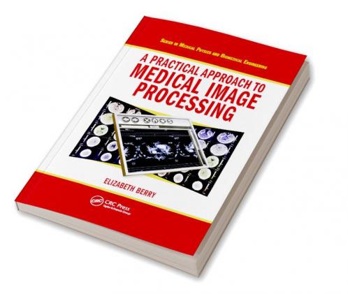 Practical Approach to Medical Image Processing